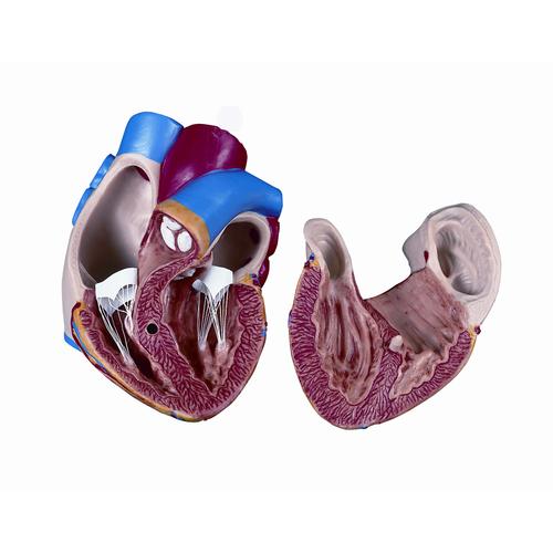 Spare heart, 2 parts