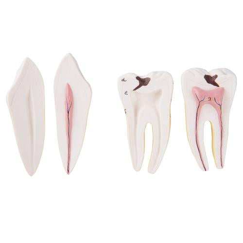 Spare canine and molar for D25