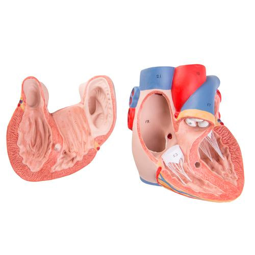 G15: Replacement Heart