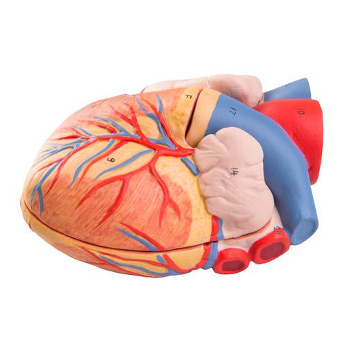 G15: Replacement Heart