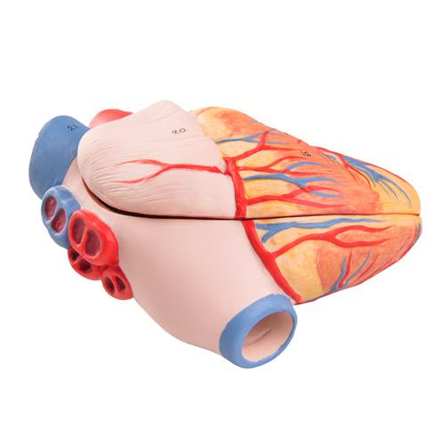 G15: Replacement Heart