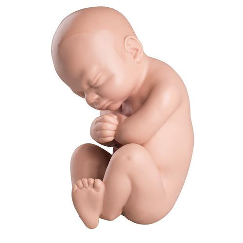 Spare fetus for L20