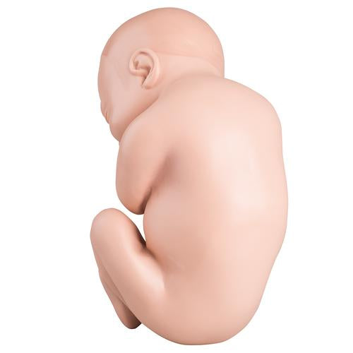 Spare fetus for L20