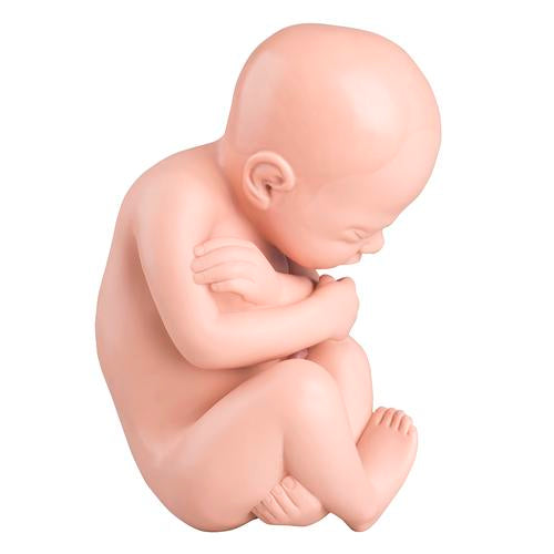 Spare fetus for L20