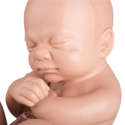 Spare fetus for L20