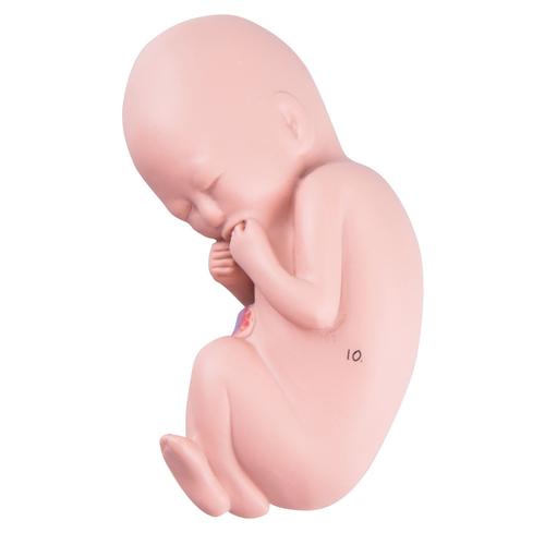 Spare fetus for L10/6