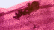 Microscope Slide, Taenia Immature Proglottid, from Cow or Sheep
