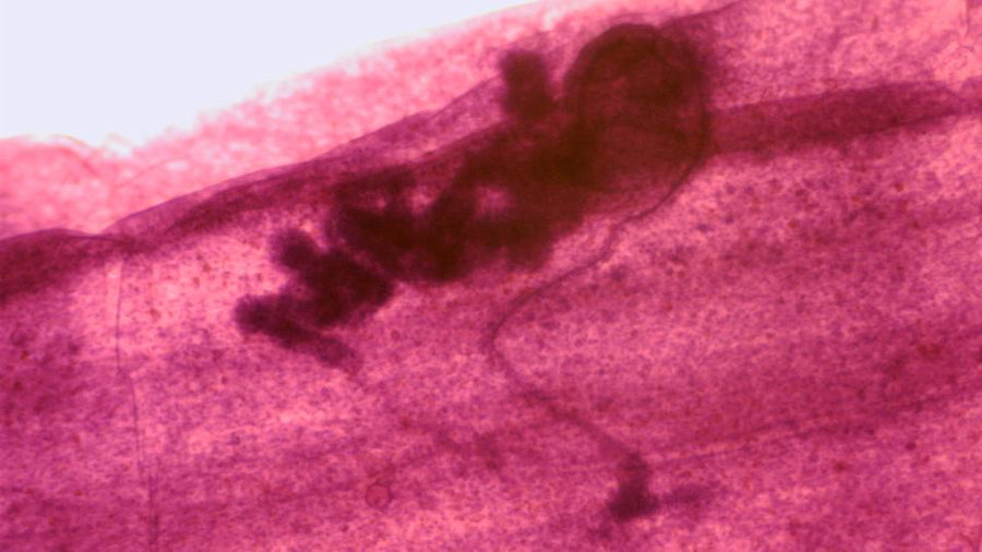 Microscope Slide, Taenia Immature Proglottid, from Cow or Sheep