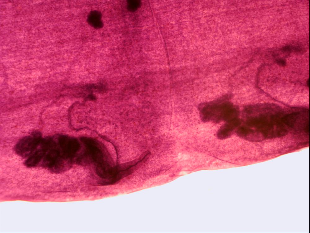 Microscope Slide, Taenia Immature Proglottid, from Cow or Sheep