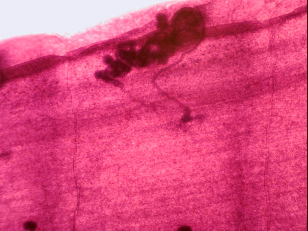 Microscope Slide, Taenia Immature Proglottid, from Cow or Sheep