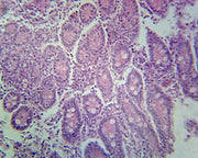 Microscope Slide, Frog Stomach; Section; H&E Stain