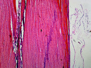 Microscope Slide, Prepared Microscope Slide Muscle-Tendon Junction, Mammalian, Longitudinal Section, H&E Stain