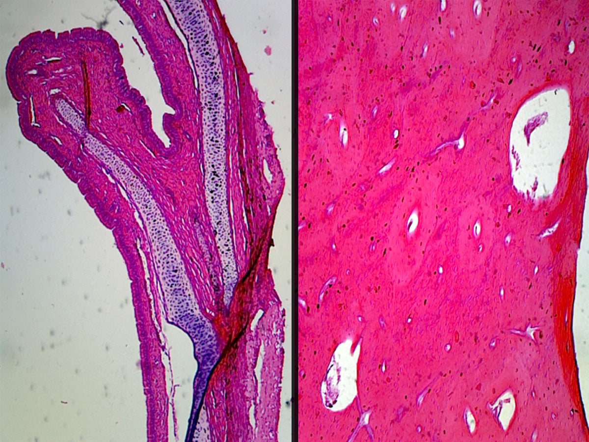 Microscope Slide, Compact Bone, Decalcified Preparation; Cross Section and Longitudinal Section