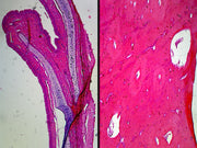 Microscope Slide, Compact Bone, Decalcified Preparation; Cross Section and Longitudinal Section