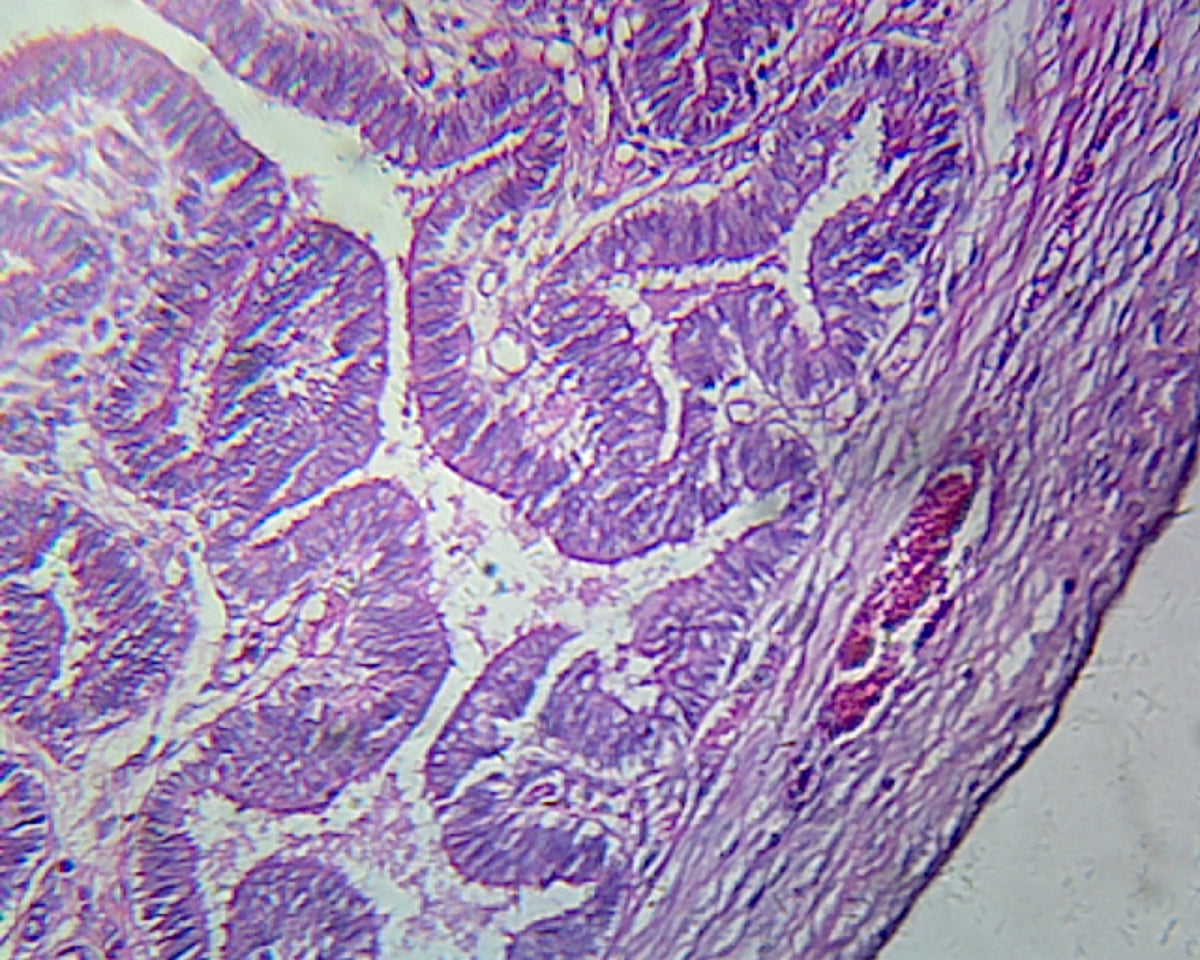 Microscope Slide, Fallopian Tube, Human; Showing General Oviduct Structure; Cross Section