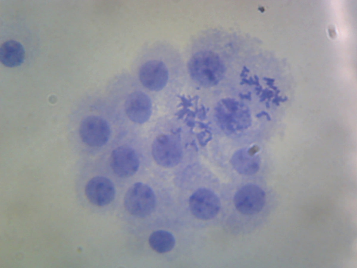 Microscope Slide, Male Chromosomes, Human; Smear