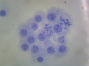 Microscope Slide, Male Chromosomes, Human; Smear