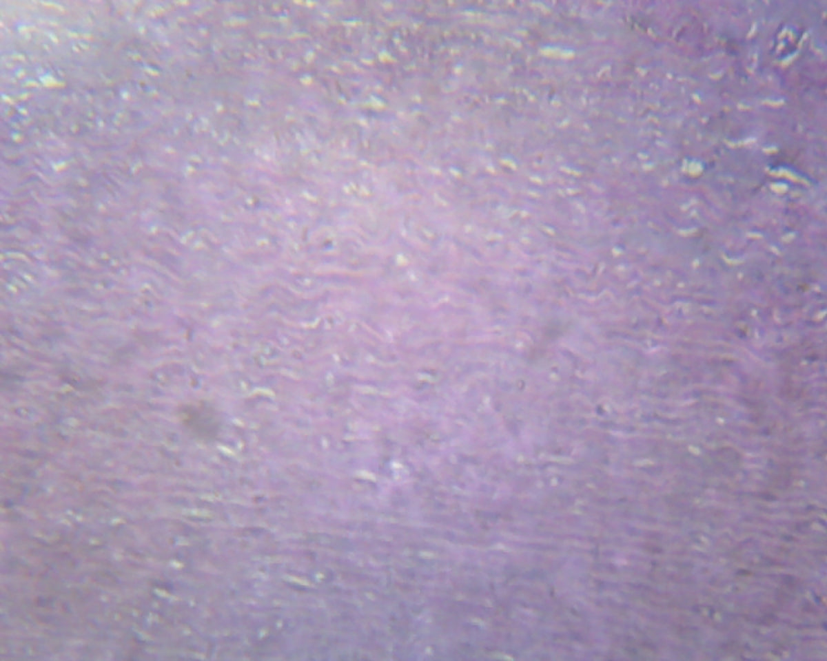 Microscope Slide, Atherosclerosis (Human); Section; H&E Stain; Showing Section of Coronary Artery
