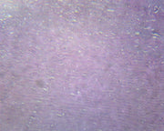 Microscope Slide, Atherosclerosis (Human); Section; H&E Stain; Showing Section of Coronary Artery