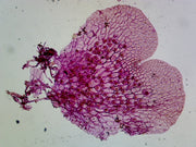 Microscope Slide, Fern (Pteridophyta) Prothallium, Showing Gametophytes; Cross Section