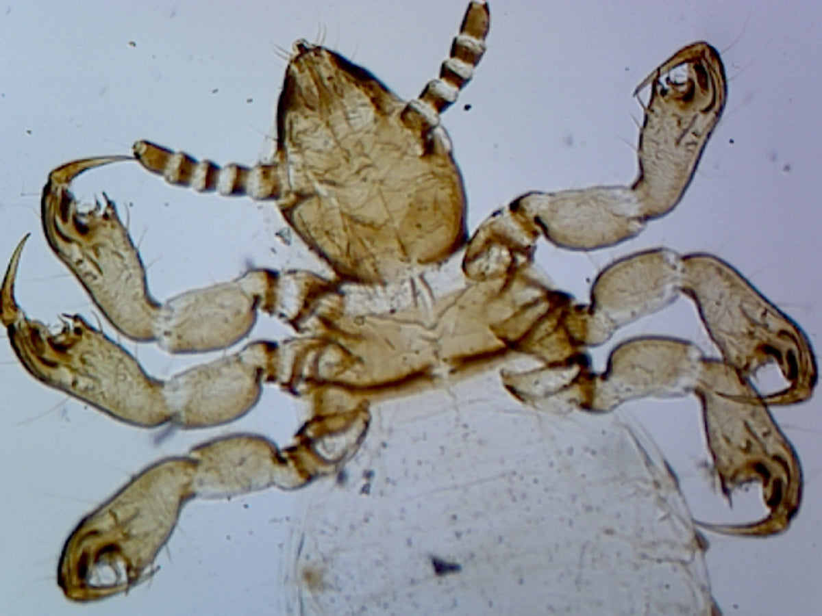 Microscope Slide, Pediculus Humanus Capitis, Female; Whole-Mount