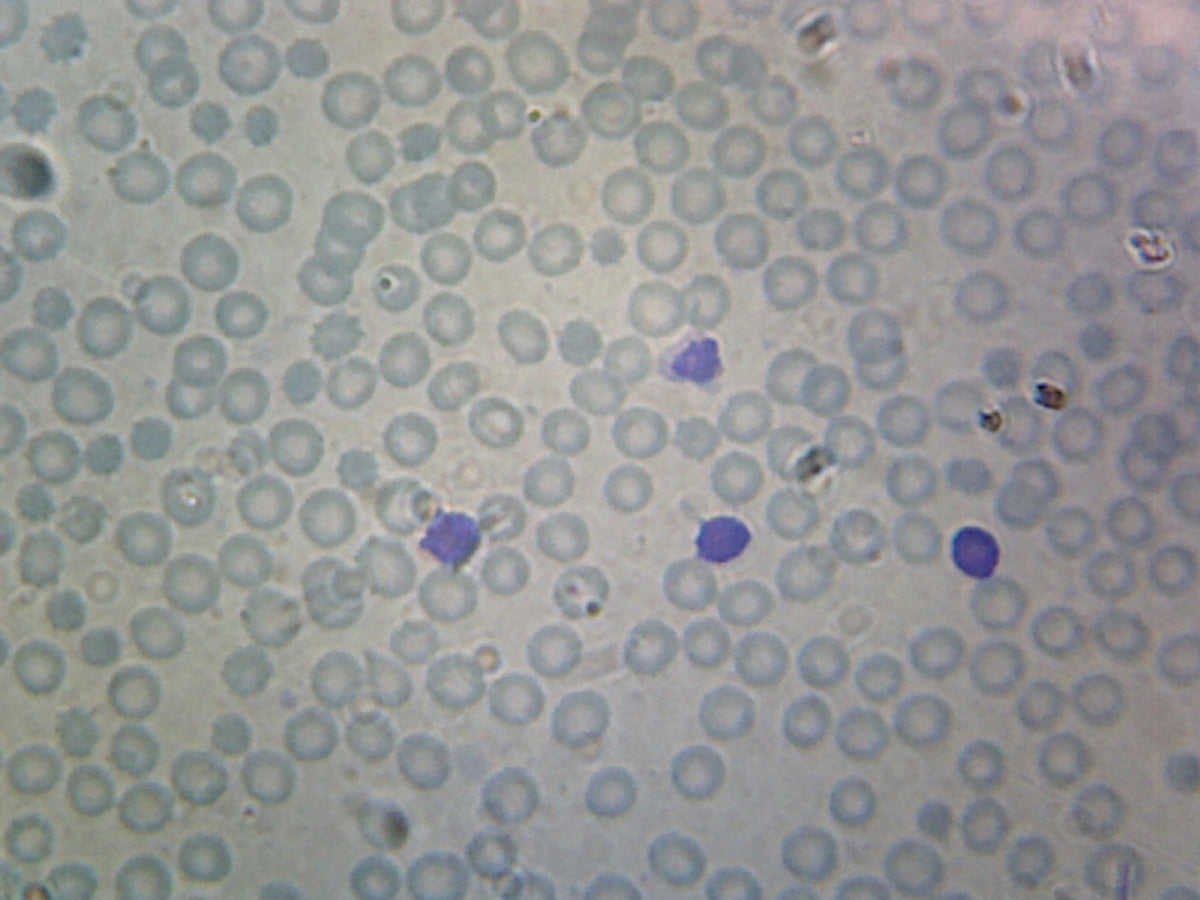 Microscope Slide, Human Blood; Smear; WR Stain
