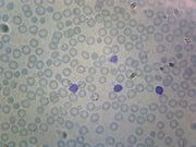 Microscope Slide, Human Blood; Smear; WR Stain