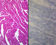 Microscope Slide, Cardiac Muscle, Mammalian; Cross Section and Longitudinal Sections