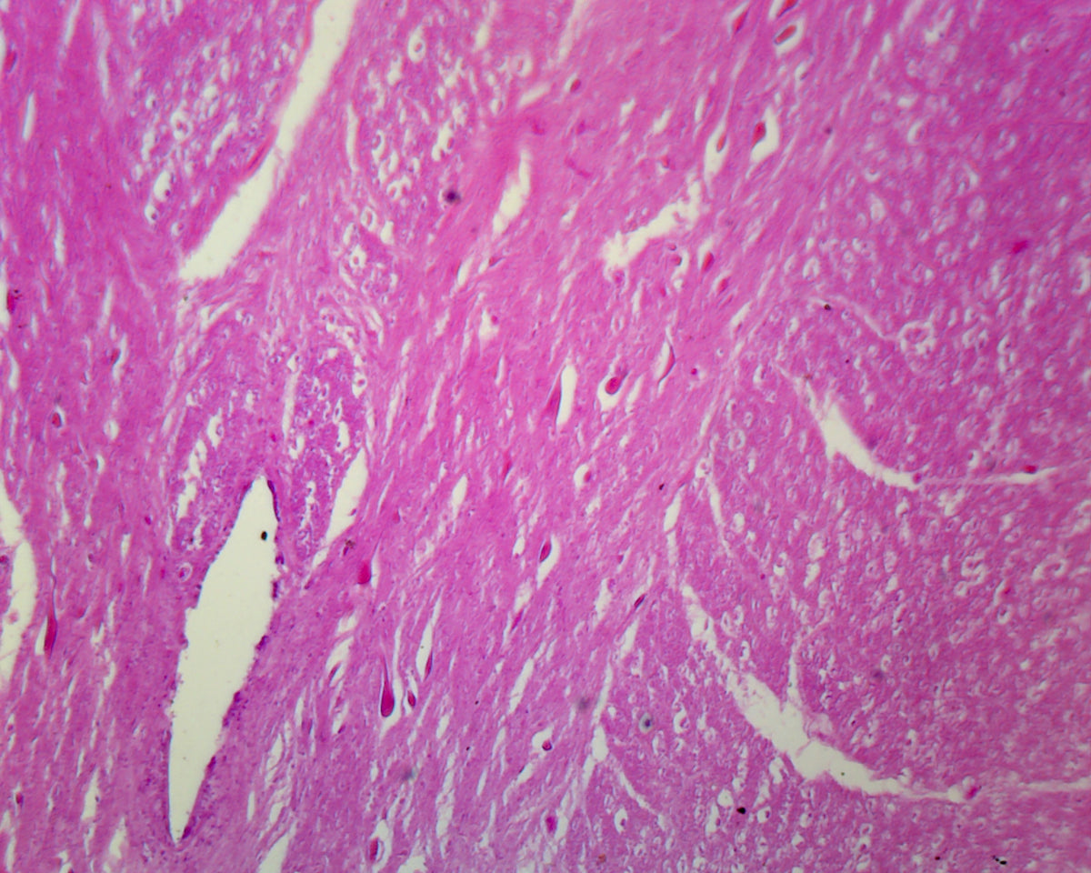 Microscope Slide, Spinal Ganglion and Nerve
