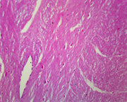 Microscope Slide, Spinal Ganglion and Nerve