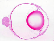 Retina and Tapetum, Mammalian; Longitudinal Section; H&E Stain; Showing Optic Nerve Entrance