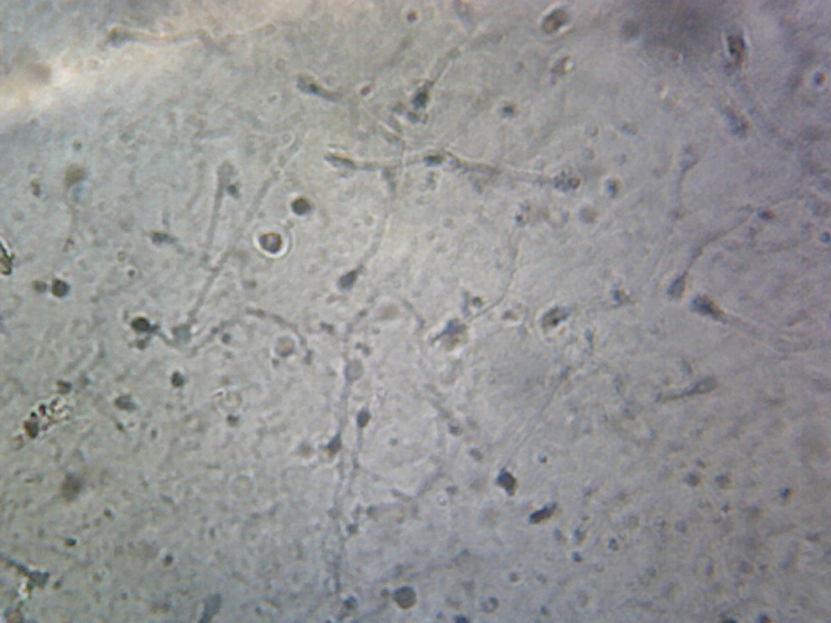 Microscope Slide, Sperm, Human; Smear