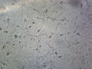 Microscope Slide, Sperm, Human; Smear
