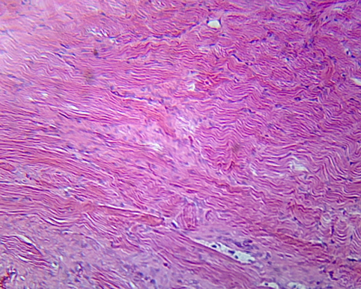 Microscope Slide, Female Urethra, Mammalian; Cross Section