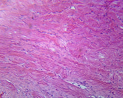 Microscope Slide, Female Urethra, Mammalian; Cross Section
