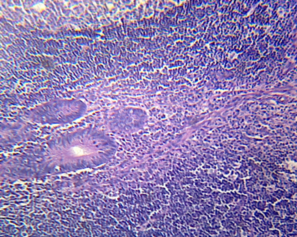 Microscope Slide, Vermiform Appendix; Section
