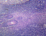 Microscope Slide, Vermiform Appendix; Section